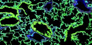 Полноценные лёгкие получены с помощью пересадки стволовых клеток